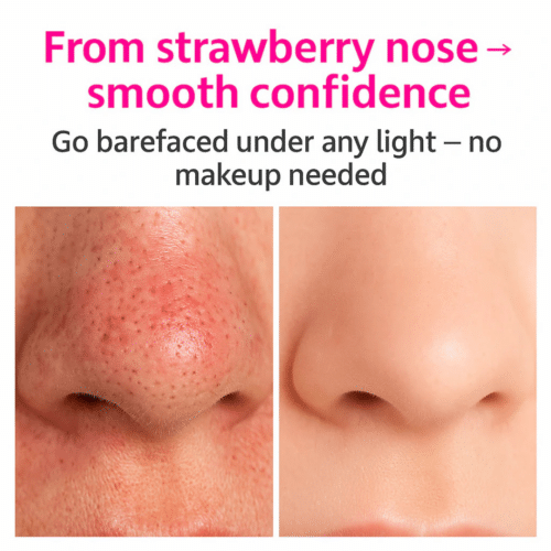 Eversmooth Porelift (Official Retailer) [year]
